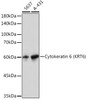 Anti-Cytokeratin 6 KRT6 Antibody CAB4631