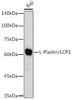 Anti-L-Plastin/LCP1 Antibody CAB4664