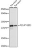 Anti-P23/PTGES3 Antibody CAB5194