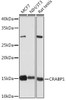 Anti-CRABP1 Antibody CAB5434