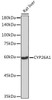 Anti-CYP26A1 Antibody CAB5982