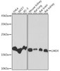 Anti-LMO4 Antibody CAB5999
