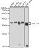 Anti-SRSF10 Antibody CAB6024