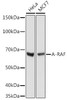 Anti-A-RAF Antibody CAB8687
