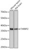 Anti-TARBP2 Antibody CAB9105