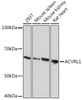 Anti-ACVRL1 Antibody CAB9755