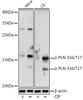 Anti-Phospho-PLN-S16/T17 Antibody CABP0956