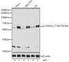 Anti-Phospho-VANGL2-T78/S79/S82 Antibody CABP1206