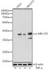 Anti-Phospho-I?Balpha-S32 Antibody CABP1220