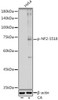 Anti-Phospho-NF2-S518 Antibody CABP1225