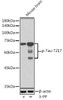 Anti-Phospho-Tau-T217 Antibody CABP1233