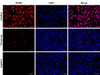 Fluorescence microscope analysis of camptothecin-induced apoptosis of Hela cells.
