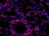 Paraffin embedded mouse lung was treated with DNase I to fragment the DNA. DNA strand breaks showed intense fluorescent staining in DNase I treated sample (red). The cells were counterstained with DAPI (blue).