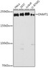 Western blot analysis of extracts of various cell lines, using DNMT1 antibody at 1:1000 dilution. Secondary antibody: HRP Goat Anti-Rabbit IgG (H+L) at 1:10000 dilution. Lysates/proteins: 25ug per lane. Blocking buffer: 3% nonfat dry milk in TBST. Detection: ECL Basic Kit. Exposure time: 90s.