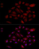 Immunofluorescence analysis of A-549 cells using PGP9. 5/UCHL1 Rabbit mAb at dilution of 1:100 (40x lens). Blue: DAPI for nuclear staining.
