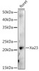 Western blot analysis of extracts of various tissues from the japonica rice (Oryza sativa L. ) variety Zhonghua 11, using Xa23 antibody at 1:1000 dilution. Secondary antibody: HRP Goat Anti-Rabbit IgG (H+L) at 1:10000 dilution. Lysates/proteins: 25ug per lane. Blocking buffer: 3% nonfat dry milk in TBST. Detection: ECL Enhanced Kit. Exposure time: 30s.