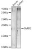 Western blot analysis of extracts of various tissues from the japonica rice (Oryza sativa L. ) variety Zhonghua 11, using OsFD2 antibody at 1:1000 dilution. Secondary antibody: HRP Goat Anti-Rabbit IgG (H+L) at 1:10000 dilution. Lysates/proteins: 25ug per lane. Blocking buffer: 3% nonfat dry milk in TBST. Detection: ECL Enhanced Kit. Exposure time: 600s.