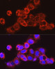 Immunofluorescence analysis of HepG2 cells using UGT2B17 Rabbit pAb at dilution of 1:200 (40x lens). Blue: DAPI for nuclear staining.