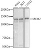 Western blot analysis of extracts of various cell lines, using MCM2 antibody at 1:1000 dilution. Secondary antibody: HRP Goat Anti-Rabbit IgG (H+L) at 1:10000 dilution. Lysates/proteins: 25ug per lane. Blocking buffer: 3% nonfat dry milk in TBST. Detection: ECL Basic Kit. Exposure time: 0. 3s.