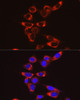 Immunofluorescence analysis of NIH/3T3 cells using GSDMD Rabbit mAb at dilution of 1:100 (40x lens). Blue: DAPI for nuclear staining.