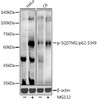 Western blot analysis of extracts of various cell lines, using Phospho-SQSTM1/p62-S349 antibody at 1:500 dilution. HeLa cells and C6 cells were treated by MG132(50 μM) at 37℃ for 90 minutes. Secondary antibody: HRP Goat Anti-Rabbit IgG (H+L) at 1:10000 dilution. Lysates/proteins: 25ug per lane. Blocking buffer: 3% nonfat dry milk in TBST. Detection: ECL Enhanced Kit. Exposure time: 90s.