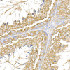 Immunohistochemistry of paraffin-embedded mouse testis using USP9Y Rabbit pAb at dilution of 1:150 (40x lens). Perform high pressure antigen retrieval with 10 mM citrate buffer pH 6. 0 before commencing with IHC staining protocol.