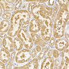 Immunohistochemistry of paraffin-embedded rat kidney using USP9Y Rabbit pAb at dilution of 1:150 (40x lens). Perform high pressure antigen retrieval with 10 mM citrate buffer pH 6. 0 before commencing with IHC staining protocol.
