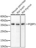 Western blot analysis of extracts of various cell lines, using PQBP1 antibody at 1:1000 dilution. Secondary antibody: HRP Goat Anti-Rabbit IgG (H+L) at 1:10000 dilution. Lysates/proteins: 25ug per lane. Blocking buffer: 3% nonfat dry milk in TBST. Detection: ECL Basic Kit. Exposure time: 3s.