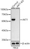 Western blot analysis of extracts from normal (control) and AKT1 knockout (KO) HeLa cells, using AKT1 antibody at 1:1000 dilution. Secondary antibody: HRP Goat Anti-Rabbit IgG (H+L) at 1:10000 dilution. Lysates/proteins: 25ug per lane. Blocking buffer: 3% nonfat dry milk in TBST. Detection: ECL Basic Kit. Exposure time: 90s.