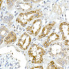 Immunohistochemistry of paraffin-embedded human kidney using AMACR Rabbit mAb at dilution of 1:50 (40x lens). Perform high pressure antigen retrieval with 10 mM citrate buffer pH 6. 0 before commencing with IHC staining protocol.