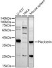 Western blot analysis of extracts of various cell lines, using Pleckstrin antibody at 1:500 dilution. Secondary antibody: HRP Goat Anti-Rabbit IgG (H+L) at 1:10000 dilution. Lysates/proteins: 25ug per lane. Blocking buffer: 3% nonfat dry milk in TBST. Detection: ECL Basic Kit. Exposure time: 180s.