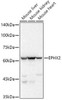 Western blot analysis of extracts of various cell lines, using EPHX2 antibody at 1:500 dilution. Secondary antibody: HRP Goat Anti-Rabbit IgG (H+L) at 1:10000 dilution. Lysates/proteins: 25ug per lane. Blocking buffer: 3% nonfat dry milk in TBST. Detection: ECL Basic Kit. Exposure time: 1s.
