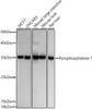 Western blot analysis of extracts of various cell lines, using Pyrophosphatase 1 antibody at 1:500 dilution. Secondary antibody: HRP Goat Anti-Rabbit IgG (H+L) at 1:10000 dilution. Lysates/proteins: 25ug per lane. Blocking buffer: 3% nonfat dry milk in TBST. Detection: ECL Basic Kit. Exposure time: 1s.