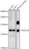 Western blot analysis of extracts of various cell lines, using PEX11B antibody at 1:1000 dilution. Secondary antibody: HRP Goat Anti-Rabbit IgG (H+L) at 1:10000 dilution. Lysates/proteins: 25ug per lane. Blocking buffer: 3% nonfat dry milk in TBST. Detection: ECL Basic Kit. Exposure time: 10s.