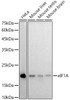 Western blot analysis of extracts of various cell lines, using eIF1A antibody at 1:1000 dilution. Secondary antibody: HRP Goat Anti-Rabbit IgG (H+L) at 1:10000 dilution. Lysates/proteins: 25ug per lane. Blocking buffer: 3% nonfat dry milk in TBST. Detection: ECL Basic Kit. Exposure time: 180s.