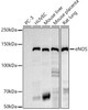 Western blot analysis of extracts of various cell lines, using eNOS antibody at 1:1000 dilution. Secondary antibody: HRP Goat Anti-Rabbit IgG (H+L) at 1:10000 dilution. Lysates/proteins: 25ug per lane. Blocking buffer: 3% nonfat dry milk in TBST. Detection: ECL Basic Kit. Exposure time: 180s.