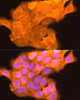 Immunofluorescence analysis of A431 cells using LORICRIN Rabbit pAb at dilution of 1:200 (40x lens). Blue: DAPI for nuclear staining.