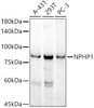 Western blot analysis of extracts of various cell lines, using NPHP1 antibody at 1:1000 dilution. Secondary antibody: HRP Goat Anti-Rabbit IgG (H+L) at 1:10000 dilution. Lysates/proteins: 25ug per lane. Blocking buffer: 3% nonfat dry milk in TBST. Detection: ECL Basic Kit. Exposure time: 180s.