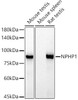 Western blot analysis of extracts of various cell lines, using NPHP1 antibody at 1:1000 dilution. Secondary antibody: HRP Goat Anti-Rabbit IgG (H+L) at 1:10000 dilution. Lysates/proteins: 25ug per lane. Blocking buffer: 3% nonfat dry milk in TBST. Detection: ECL Basic Kit. Exposure time: 90s.