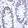 Immunohistochemistry of paraffin-embedded human tonsil using PLK1 Rabbit mAb at dilution of 1:100 (40x lens). Perform high pressure antigen retrieval with 10 mM citrate buffer pH 6. 0 before commencing with IHC staining protocol.