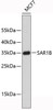 Western blot analysis of extracts of MCF-7 cells, using SAR1B antibody . Secondary antibody: HRP Goat Anti-Rabbit IgG (H+L) at 1:10000 dilution. Lysates/proteins: 25ug per lane. Blocking buffer: 3% nonfat dry milk in TBST.