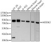 Western blot analysis of extracts of various cell lines, using at 1:500 dilution. Secondary antibody: HRP Goat Anti-Rabbit IgG (H+L) at 1:10000 dilution. Lysates/proteins: 25ug per lane. Blocking buffer: 3% nonfat dry milk in TBST. Detection: ECL Basic Kit. Exposure time: 3s.