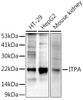 Western blot analysis of extracts of various cell lines, using at 1:1000 dilution. Secondary antibody: HRP Goat Anti-Rabbit IgG (H+L) at 1:10000 dilution. Lysates/proteins: 25ug per lane. Blocking buffer: 3% nonfat dry milk in TBST. Detection: ECL Enhanced Kit. Exposure time: 180s.