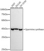 Western blot analysis of extracts of various cell lines, using at 1:1000 dilution. Secondary antibody: HRP Goat Anti-Rabbit IgG (H+L) at 1:10000 dilution. Lysates/proteins: 25ug per lane. Blocking buffer: 3% nonfat dry milk in TBST. Detection: ECL Basic Kit. Exposure time: 10s.