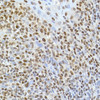 Immunohistochemistry of paraffin-embedded human tonsil using TAF15 Rabbit mAb at dilution of 1:25 (40x lens). Perform high pressure antigen retrieval with 10 mM citrate buffer pH 6. 0 before commencing with IHC staining protocol.