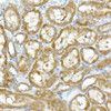 Immunohistochemistry of paraffin-embedded rat kidney using RPL13 Rabbit mAb at dilution of 1:50 (40x lens). Perform high pressure antigen retrieval with 10 mM citrate buffer pH 6. 0 before commencing with IHC staining protocol.