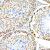 Immunohistochemistry of paraffin-embedded mouse testis using Phospho-Histone H3. 3-S31 Rabbit mAb at dilution of 1:50 (40x lens). Perform high pressure antigen retrieval with 10 mM citrate buffer pH 6. 0 before commencing with IHC staining protocol.