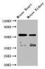 Western Blot<br />
Positive WB detected in: Mouse heart tissue,Mouse kidney tissue<br />
All lanes: ompF antibody at 1:2000<br />
Secondary<br />
Goat polyclonal to rabbit IgG at 1/50000 dilution<br />
Predicted band size: 57 kDa<br />
Observed band size: 57 kDa<br />