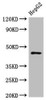 Western Blot<br />
Positive WB detected in: HepG2 whole cell lysate<br />
All lanes: HLA-B antibody at 1:1000<br />
Secondary<br />
Goat polyclonal to rabbit IgG at 1/50000 dilution<br />
Predicted band size: 41 kDa<br />
Observed band size: 45 kDa<br />