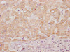 IHC image of PACO64781 diluted at 1:100 and staining in paraffin-embedded human liver tissue performed on a Leica BondTM system. After dewaxing and hydration, antigen retrieval was mediated by high pressure in a citrate buffer (pH 6.0). Section was blocked with 10% normal goat serum 30min at RT. Then primary antibody (1% BSA) was incubated at 4&deg;C overnight. The primary is detected by a Goat anti-rabbit polymer IgG labeled by HRP and visualized using 0.05% DAB.